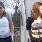 Making The Best Of A Bad Situation: A Back Brace Steampunked